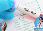 Can Blood Cancer Be Detected by a Routine CBC Test?