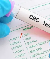 Can Blood Cancer Be Detected by a Routine CBC Test?