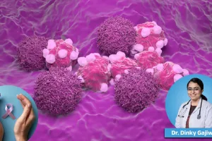 Pune Scientists Develop New Nanomedicine That Can Target Breast Cancer Cells with Minimal Side Effects
