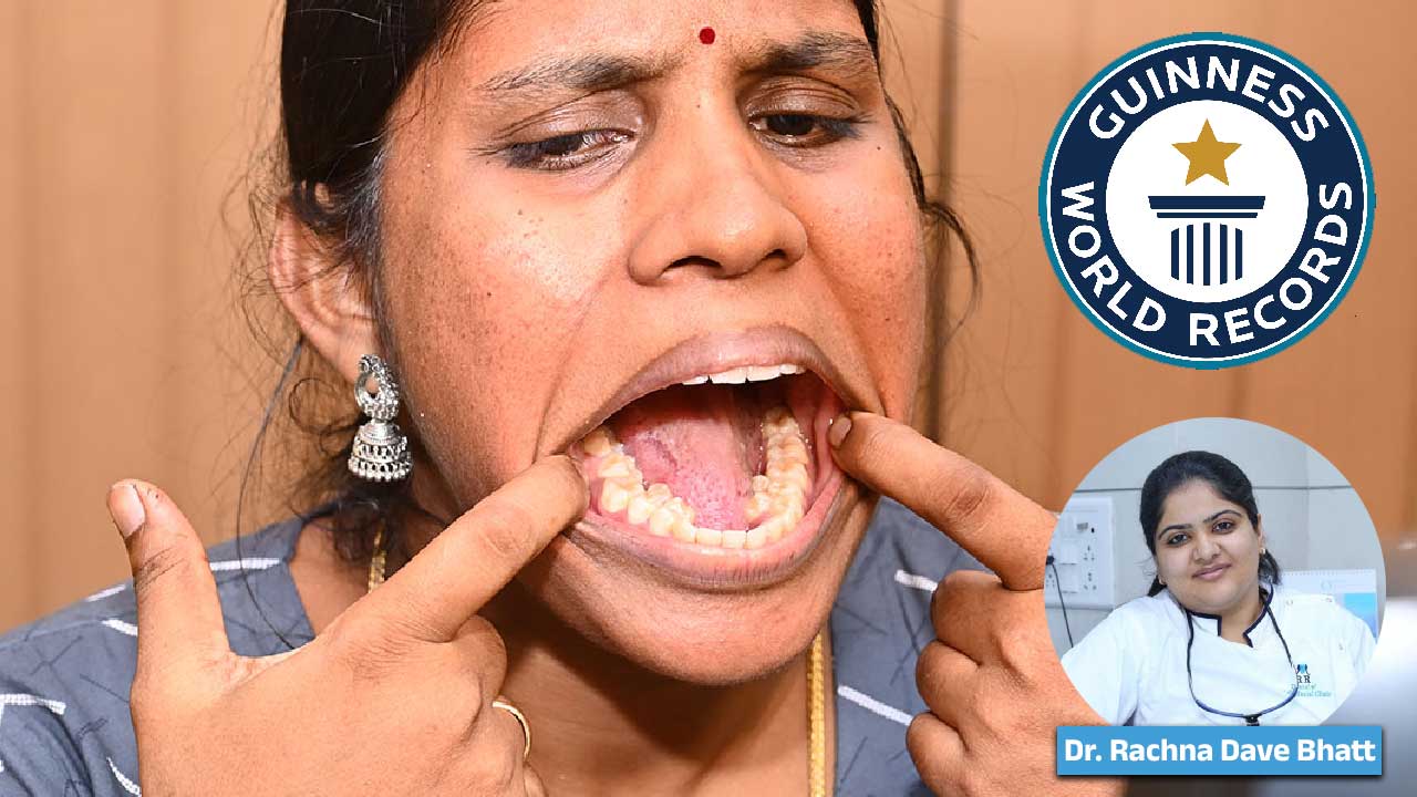 26-Year-Old Indian Woman Sets Record with 38 Teeth — Should Extra Teeth Be Removed?