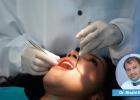 Brushing for Brain Health: Studies Link Gum Disease to Stroke Risk