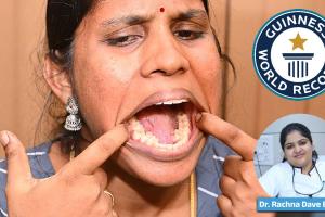 26-Year-Old Indian Woman Sets Record with 38 Teeth — Should Extra Teeth Be Removed?